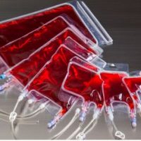 Cell Culture and Processing Bags VueLife® “AC” Series-VueLife_Ac_series.jpg